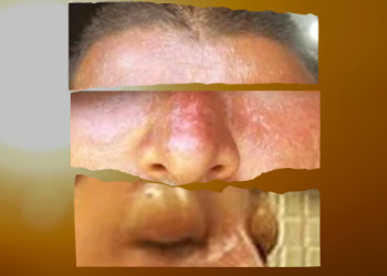 Alunos soldados da PM são socorridos com sintomas de insolação no Espírito Santo